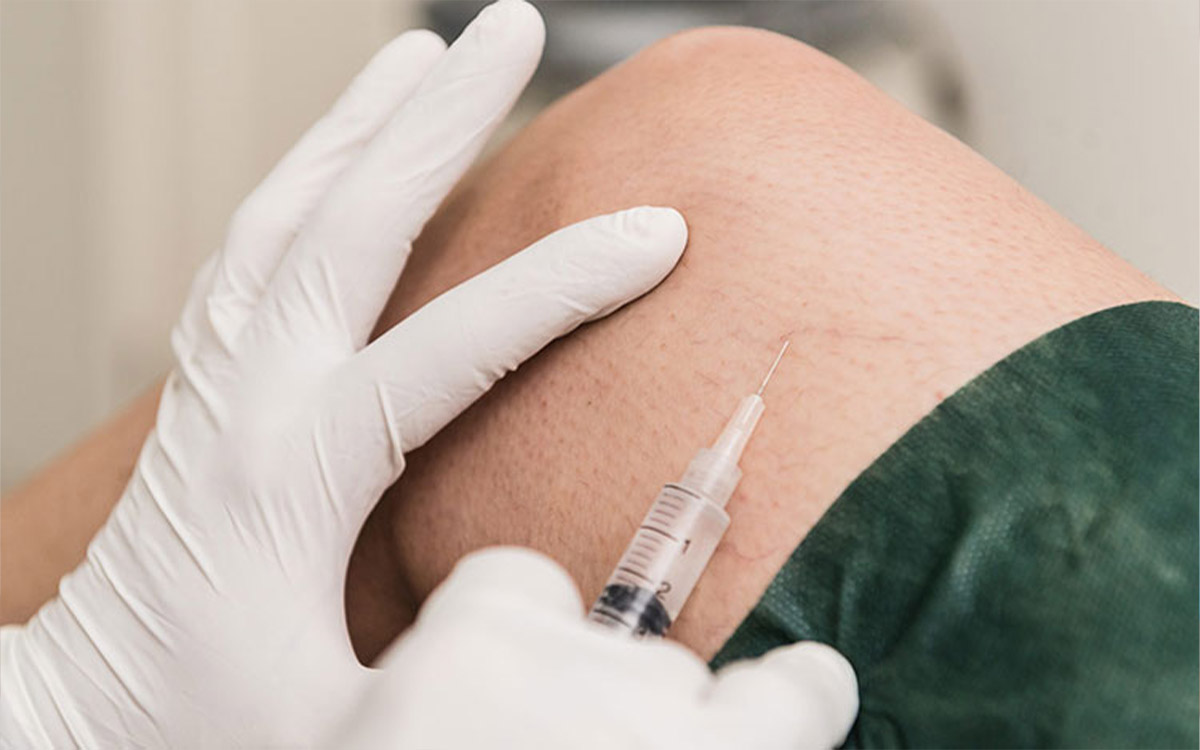 Sclerotherapy for Varicose Vein Treatment